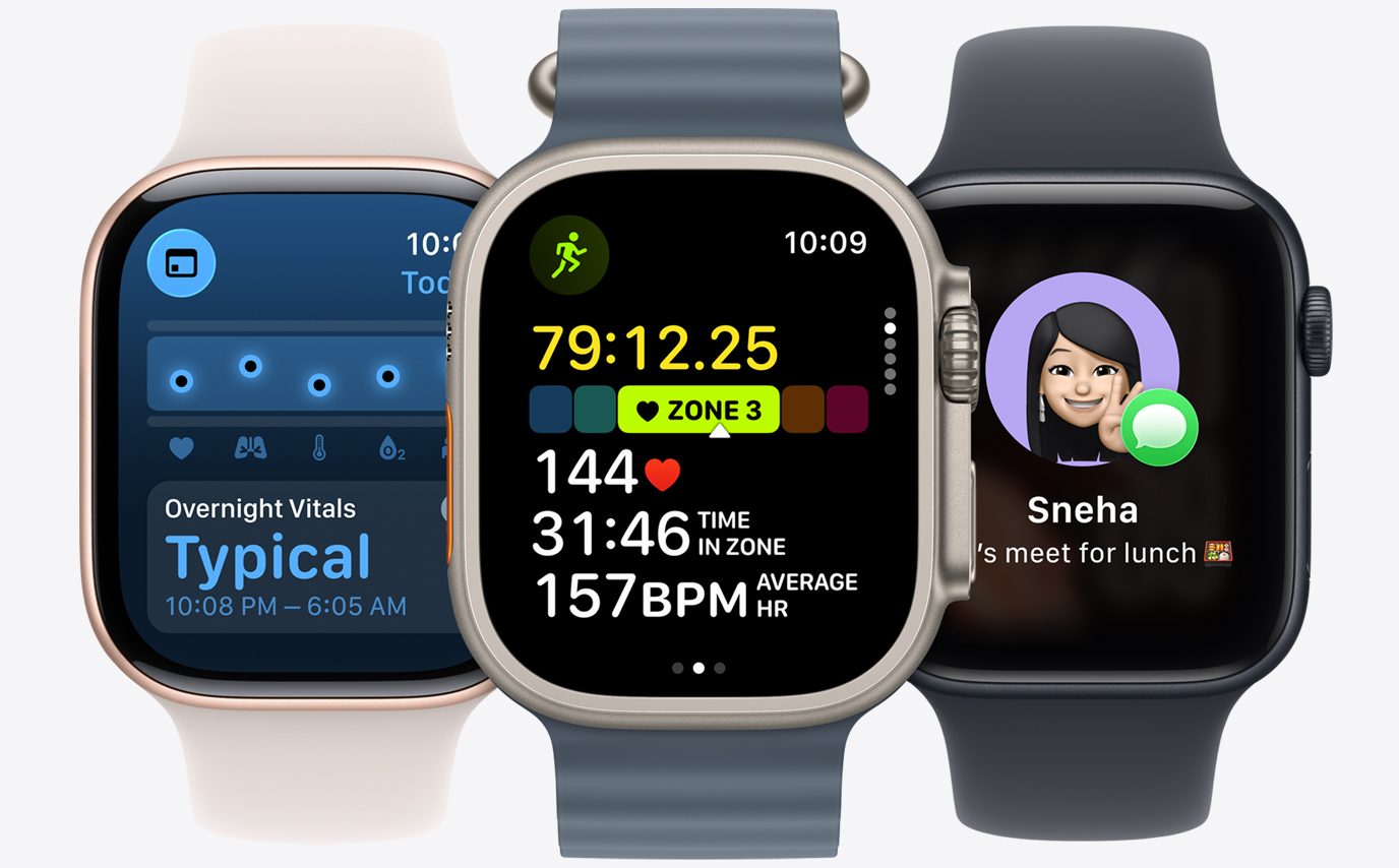 Wristwatch, Arm, Body Part