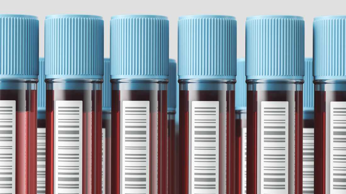 Vertical test tubes with blood with blue lids ready for test. Concept of medicine and science. 3d rendering