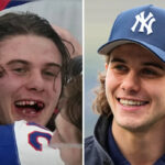 Olympic hero Jack Hughes has new chiclets as NHL dentists get a moment in the spotlight | Latest Sports News