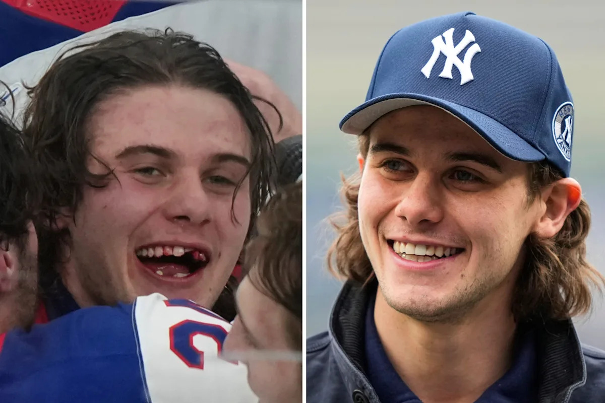 Olympic hero Jack Hughes has new chiclets as NHL dentists get a moment in the spotlight | Latest Sports News